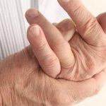 Ревматоїдний артрит: як лікувати?