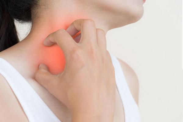 Еритема на обличчі та шиї: захворювання щитовидної залози
