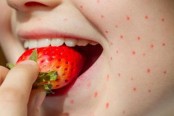Деякі факти про алергію